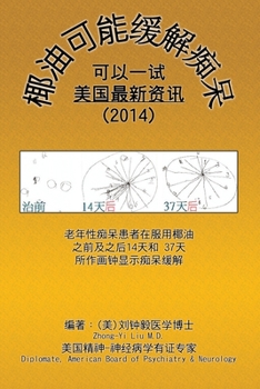 Coconut Oil May Ameliorate Dementia: ???????? (Chinese Edition)