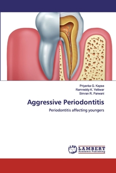 Paperback Aggressive Periodontitis Book