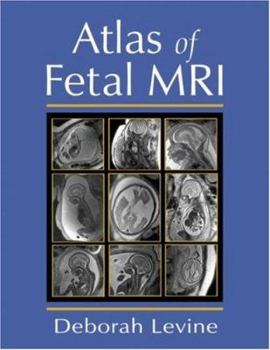 Hardcover Atlas of Fetal MRI Book