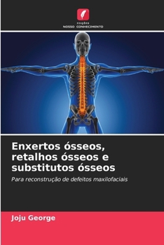 Paperback Enxertos ósseos, retalhos ósseos e substitutos ósseos [Portuguese] Book