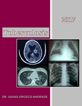 Paperback Tuberculosis 2017: Spanish Edition [Spanish] Book