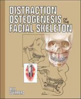 Hardcover Distraction Osteogenesis of the Facial Skeleton [With CDROM] Book