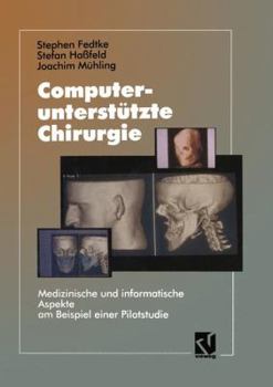 Paperback Computerunterstützte Chirurgie: Medizinische Und Informatische Aspekte Am Beispiel Einer Pilotstudie [German] Book