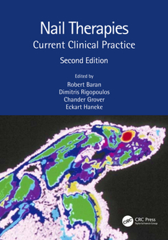 Paperback Nail Therapies: Current Clinical Practice Book