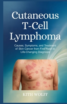 Cutaneous T-Cell Lymphoma: Causes, Symptoms, and Treatment of Skin Cancer from First Rash to Life-Changing Diagnosis