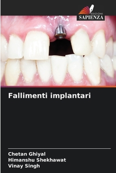Paperback Fallimenti implantari [Italian] Book