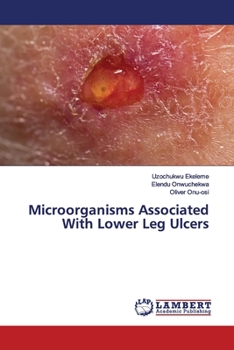 Paperback Microorganisms Associated With Lower Leg Ulcers Book
