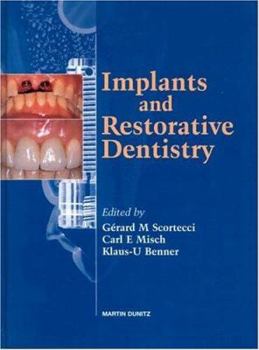 Hardcover Implants and Restorative Dentistry Book