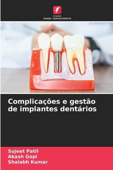 Complicações e gestão de implantes dentários (Portuguese Edition)