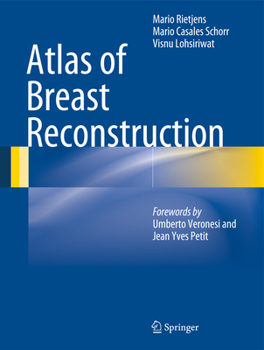 Hardcover Atlas of Breast Reconstruction Book