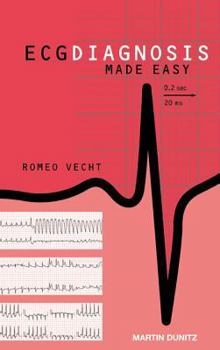 Paperback ECG Diagnosis Made Easy [With CDROM] Book