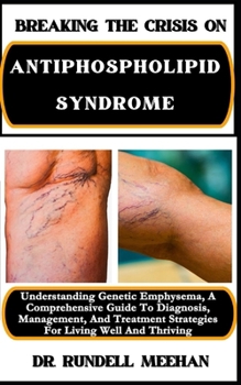 BREAKING THE CRISIS ON ANTIPHOSPHOLIPID SYNDROME: Understanding Genetic Emphysema, A Comprehensive Guide To Diagnosis, Management, And Treatment Strategies For Living Well And Thriving
