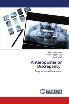 Paperback Anteroposterior Discrepancy Book