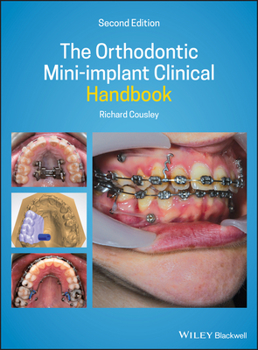 Hardcover The Orthodontic Mini-Implant Clinical Handbook Book