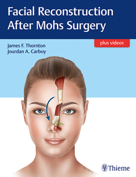 Hardcover Facial Reconstruction After Mohs Surgery Book