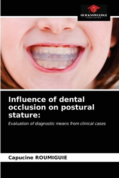 Paperback Influence of dental occlusion on postural stature Book