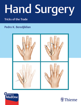 Hardcover Hand Surgery: Tricks of the Trade Book