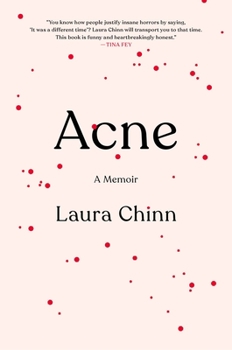 Hardcover Acne: A Memoir Book