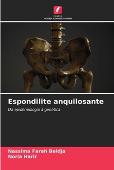 Paperback Espondilite anquilosante [Portuguese] Book