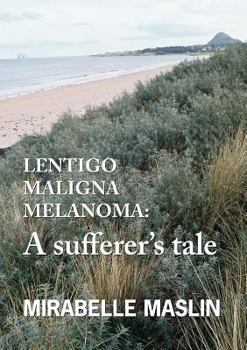 Paperback Lentigo Maligna Melanoma: A Sufferer's Tale Book