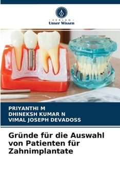 Paperback Gründe für die Auswahl von Patienten für Zahnimplantate [German] Book