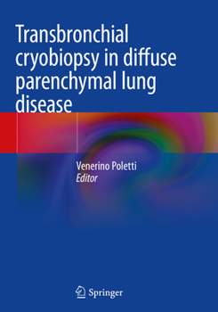 Paperback Transbronchial Cryobiopsy in Diffuse Parenchymal Lung Disease Book