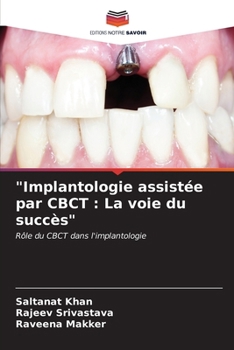 Paperback "Implantologie assistée par CBCT: La voie du succès" [French] Book