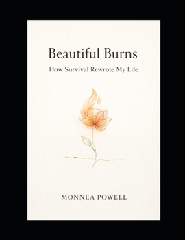 Paperback Beautiful Burns: How Survival Rewrote My Life Book