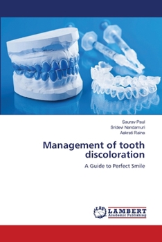 Paperback Management of tooth discoloration Book