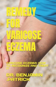 Paperback Remedy for Varicose Eczema: Varicose Eczema: How to Recognize and Treat It Book