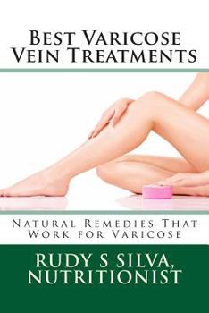 Paperback Best Varicose Vein Treatments: Natural Remedies That Work For Varicose Book