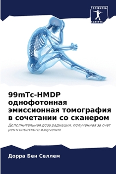 Paperback 99mTc-HMDP однофотонная эмиссиоl [Russian] Book