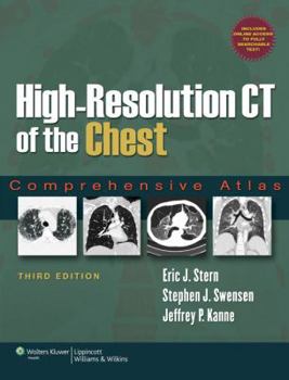 Hardcover High-Resolution CT of the Chest: Comprehensive Atlas Book