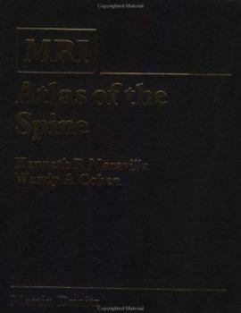 Mri Atlas of the Spine