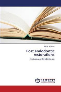 Paperback Post endodontic restorations Book