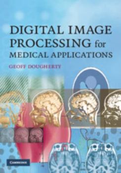 Hardcover Digital Image Processing for Medical Applications Book