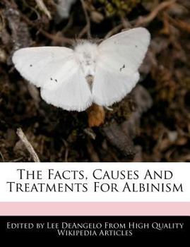 The Facts, Causes and Treatments for Albinism