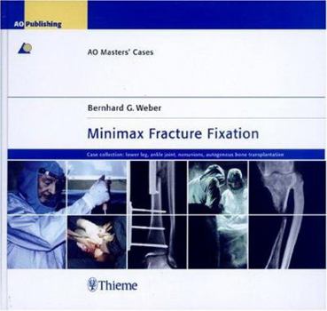 Hardcover Minimax Fracture Fixation: Case Collection: Lower Leg - Ankle Joint - Nonunions - Autogenous Bone Transplantation (Ao Master Series) Book