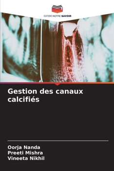 Paperback Gestion des canaux calcifiés [French] Book