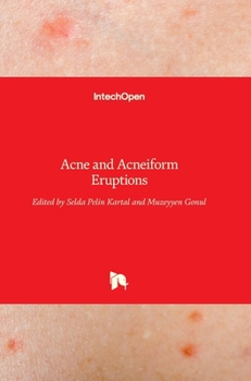 Hardcover Acne and Acneiform Eruptions Book