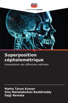 Paperback Superposition céphalométrique [French] Book