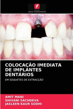 Paperback Colocação Imediata de Implantes Dentários [Portuguese] Book