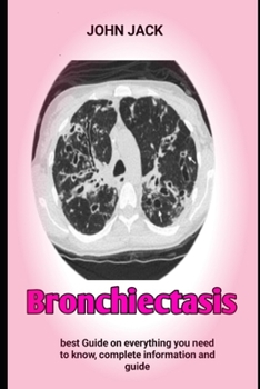 Paperback Bronchiectasis: The Complete Guide For Curing Bronchiectasis Book