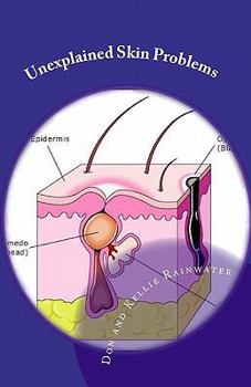 Paperback Unexplained Skin Problems: Home Treatment And Precautions Book