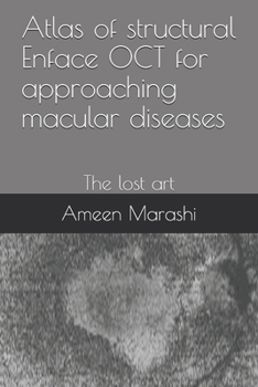 Paperback Atlas of structural Enface OCT for approaching macular diseases: The lost art Book