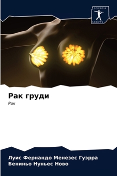 Paperback Рак груди [Russian] Book