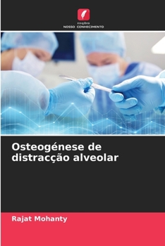 Paperback Osteogénese de distracção alveolar [Portuguese] Book