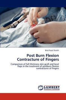 Paperback Post Burn Flexion Contracture of Fingers Book