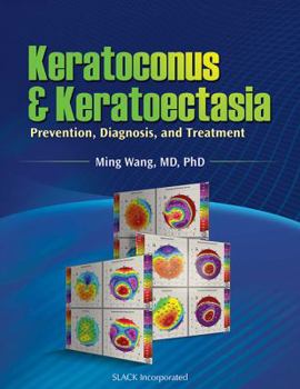 Hardcover Keratoconus & Keratoectasia: Prevention, Diagnosis, and Treatment Book