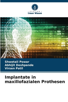 Paperback Implantate in maxillofazialen Prothesen [German] Book